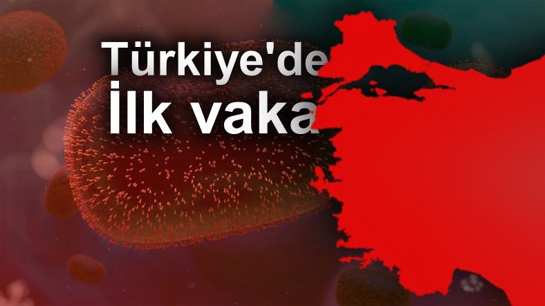 SON DAKİKA: Türkiye'de İlk Maymun Çiçeği Vakası Görüldü