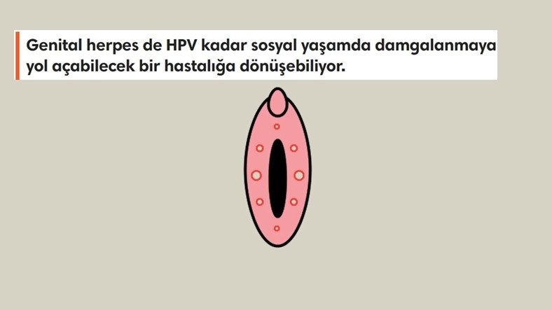 Cinsellikle Bulaşan ve Hayatınızı En Az HPV Kadar Olumsuz Etkileyen 'HSV Virüsü' Hakkında Bilmeniz Gerekenler