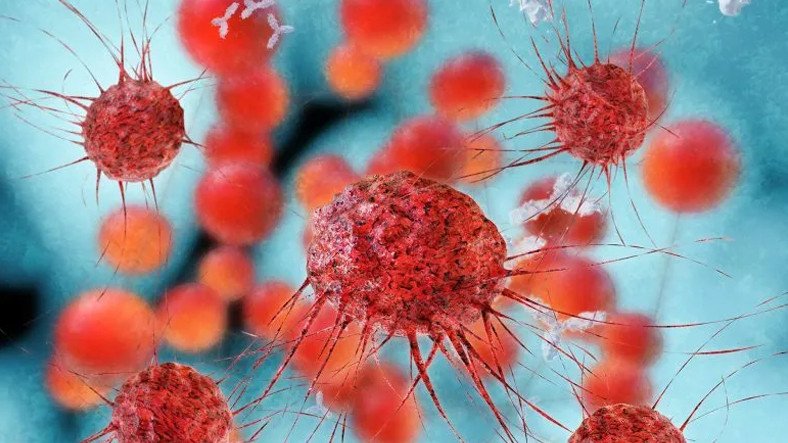 Yeni Yüksek Riskli Bir Kanser Tipi Ortaya Çıktı: Kemoterapiye Bile Yanıt Vermiyor
