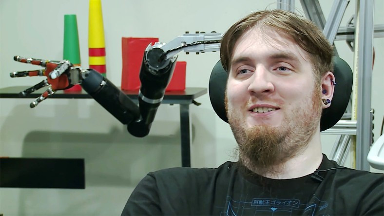 7 Yıldır Beyin-Bilgisayar Arayüzüyle Yaşayan Adam Tarihe Geçti: İşte Gerçek Cyborg!