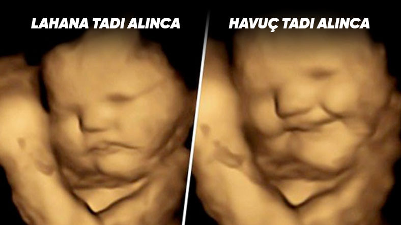Bu Görüntüler Anne Karnında Çekildi: Bebeklerin Doğmadan Önce Tat ve Koku Alabildikleri Kanıtlandı!
