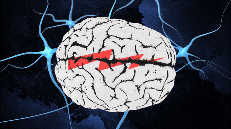 Antik Dönemden Bu Zamana Beynin Sırlarını Çözmek İçin Uğraşan Bilim Dalı: Nöroloji Nedir, Hangi Hastalıkları Kapsar?