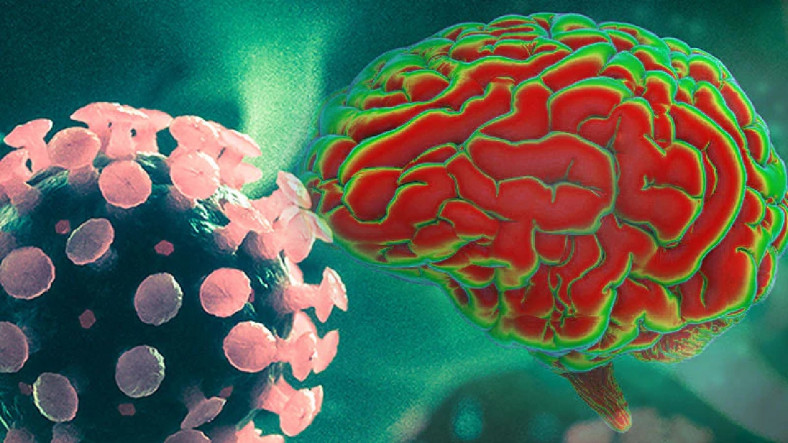 HIV'nin Beyinde de Saklanabildiği Ortaya Çıktı: Kalıcı Tedaviler Geliştirmeye Yardımcı Olabilir!