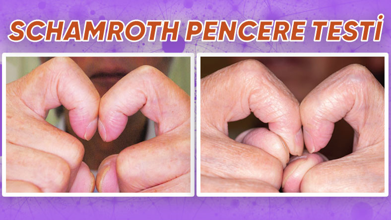 Parmaklarınızla Bu Testi Uygulayarak Mümkün Bir Hastalığınızı Erken Teşhis Edebileceğinizi Biliyor muydunuz?